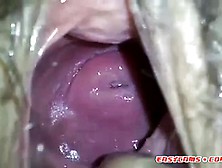 My Japanese Girlfend's Cute Cervix In Huge Hole