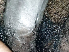 My Hairy Penis And Anus