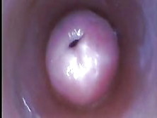 Vaginal Uterus And Intravaginal Ejaculation307