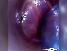 Test Tube Cock Endoscope Pov Urethral Insertion Ball Rod