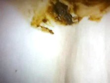 Scat Fuck Shitty Cock In Pussy Amateur Couple