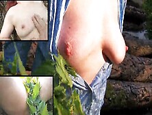 Nettle Punishment: Triple View Of Tits,  Ass And Pussy