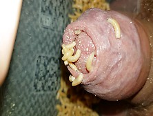 Maggot Crawl 4 Min Out Of My Foreskin