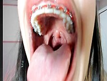 Neraks Mouth From Inside