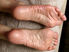 More Therapy For Lyn S Dry Feet - Part 4.