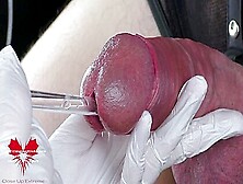 Perfect Extraction Of Sperm Directly From The Urethra.  Close-Up Of The Glass Straw Sounding
