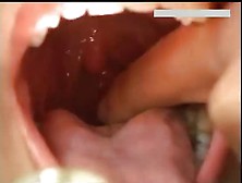Close Up Of Mouth And Gagging