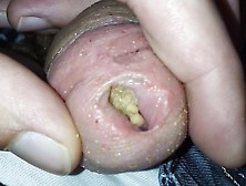 Maggot My Pee Hole