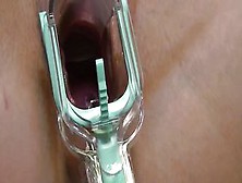 Self Examination With Speculum And Cervix Play