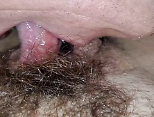 Munichgold's Fleshy Butterfly Pussy With Long Labia Is Licked And My Hairy Pussy Is Fucked