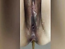 Pissing And Diarrhea In Closeup For You