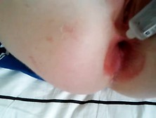 Teen Girl Has Painful Anal Sex
