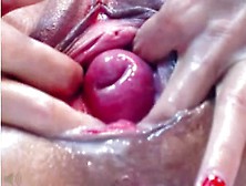 Cervix - Cervix11 - Eroprofile
