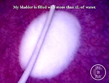 Inside Point Of View: Inflating My Bladder With Air - Preview