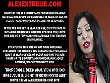 Alexextreme - Incredible Deep Anal View With Xo Speculum And Light In Hotkinkyjo Ass