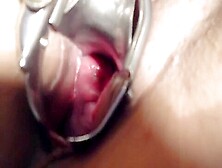 Big Dildos In Pussy Fisying Pussy Spread Cervix Sjow Speculum Squirt
