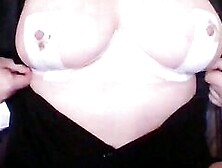 Unveiling Of My Breast After Surgery