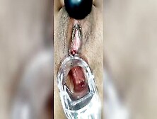 Anal Speculum With Many Orgasms With My Hitachi Sex Toy