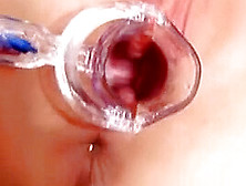 Sophie Inserts A Transparent Speculum In Her Pussy.  The