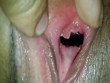 Inside Her Vagina,  Very Close,  Close-Up Bizarre,