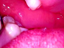 Inside My Mouth With Braces