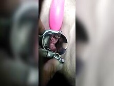 Close Up Speculum And Internal Veiw Of Squirting