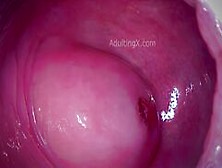 Cervix Throbbing After Orgasm And Heart Beating