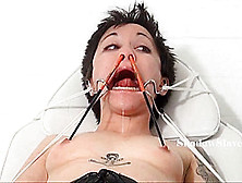 Medical Fetish Of Asian Mei Mara In Extreme Bizarre Bdsm And Japanese Patients Facial Torture And Pussy Stapling Pain