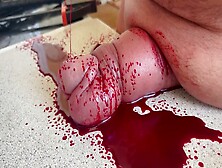 My Slave Gets 1 Liter Blood Drained From His Cock