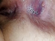 Wife's Gaping Asshole.