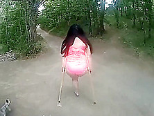 Amputee Fat In The Forest