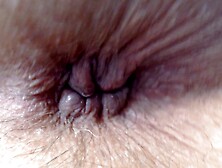 Extreme Closeup Butt-Hole Hairy Blue Fingernails