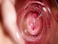 Camera Deep Inside Mia's Vagina