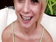 This 4 Toes 11 Brace Faced 19 Year Older Gives A Head
