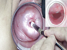 子宮にディルドと内視鏡カメラを持つ妻子宮頸部挿入 - Endoscope Camera Into Cervix