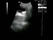 High Tech Equip Film- Abortion Doctor Scandal. Mp4