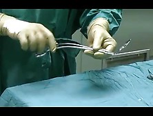 Left Venticular Assist Device Implantation Elderly Man Cm. Flv