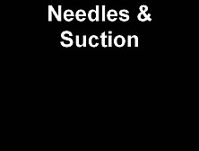 Needles & Nipple Suction