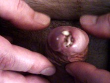 Maggots Packed In Cock Hole - 3