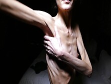 Anorexic Denisa 8T00030 14-08-2017