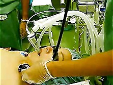 Intubation Woman For Open Heart Surgery