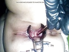 Uterus Sounding